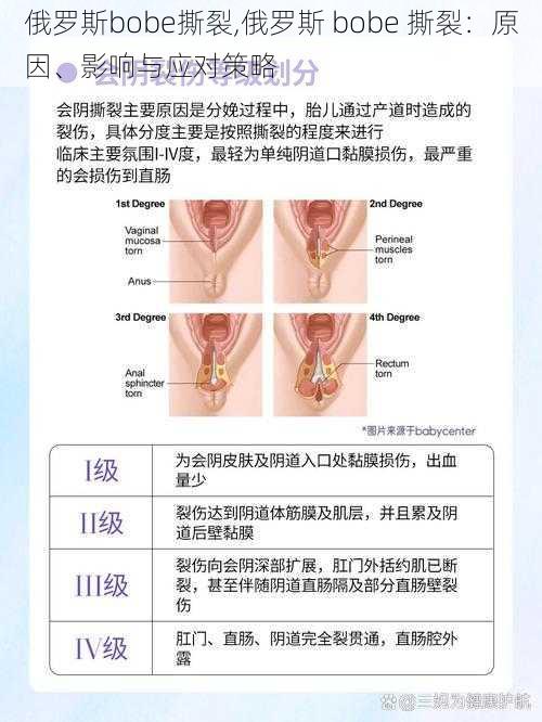 俄罗斯bobe撕裂,俄罗斯 bobe 撕裂：原因、影响与应对策略